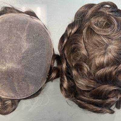 NON-EVASIVE HAIR REPLACEMENT